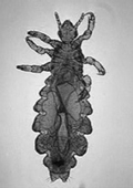 head-lice