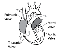 Heart Valves